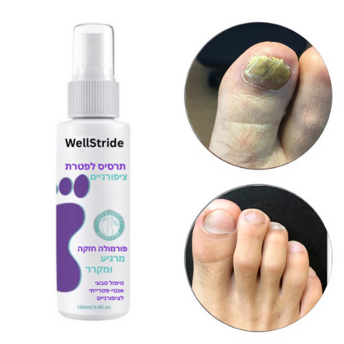 ספריי אנטי-פטרייתי לשיקום הציפורניים