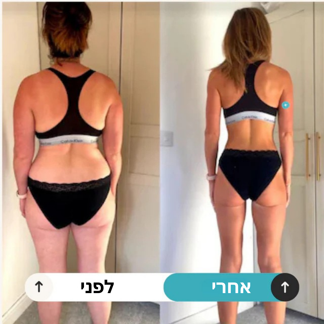 מדבקות ה-GLP-1 המקוריות